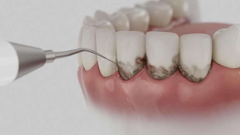 Reliable Dental contractor in Loop, PA by Smile Center Dentistry